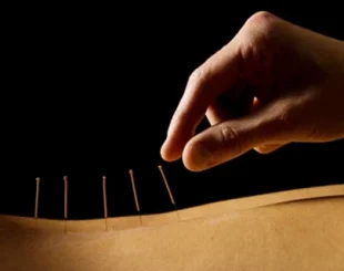 Acupuncture Physiotherapy Salford - Media City, Salford Physiotherapy, first-class physiotherapy, Back pain management, Shockwave therapy Salford