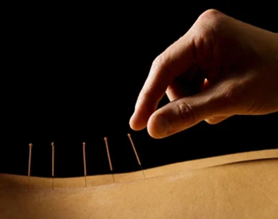 Acupuncture Physiotherapy Salford - Media City, Salford Physiotherapy, first-class physiotherapy, Back pain management, Shockwave therapy Salford
